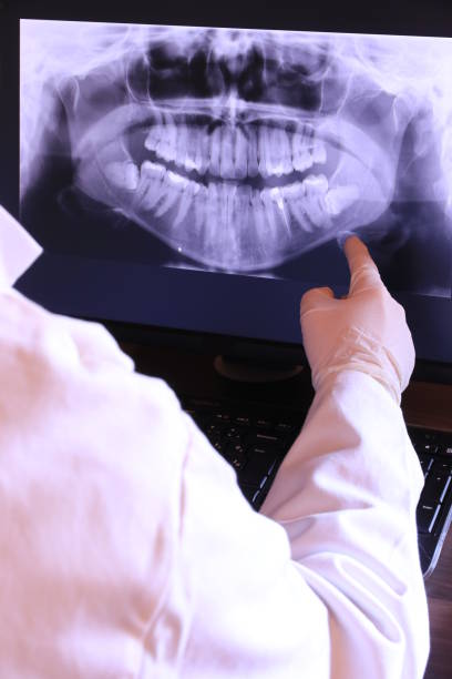 Best Root Canal Emergency Dentist  in Port Allegany, PA