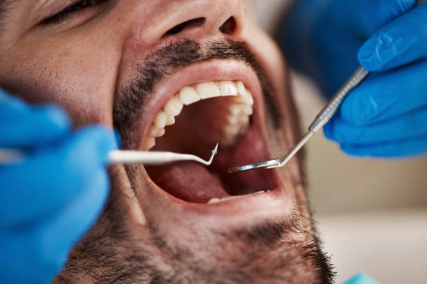 Best Cracked Tooth Emergency Dentist  in Port Allegany, PA